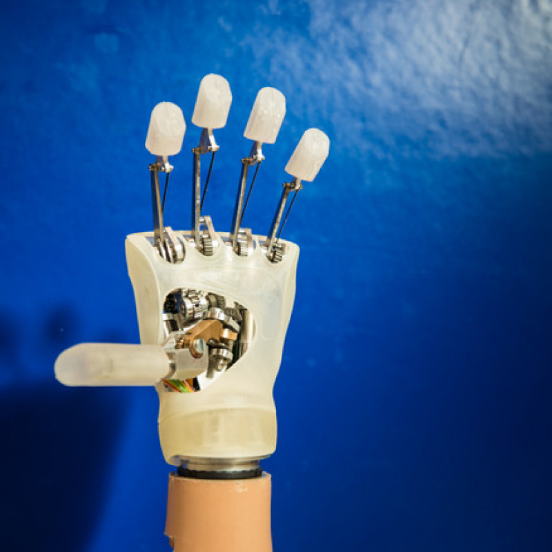 Struttura interna della mano robotica di design messo a punto nella Scuola Superiore Sant'Anna di Pisa (fonte: Scuola Superiore Sant'Anna)