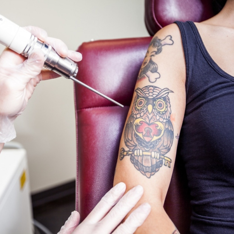 Una donna si fa fare dei tatuaggi