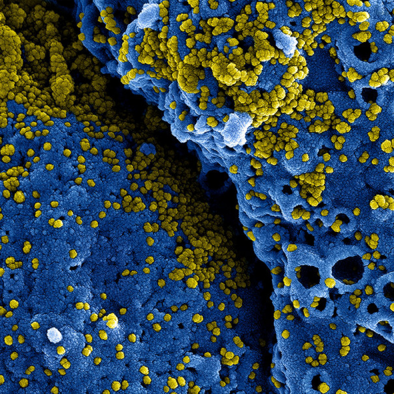 Particelle di coronavirus viste al microscopio elettronico (fonte: NIAID, Flickr)