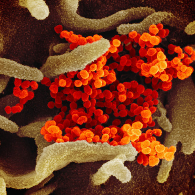 Una delle immagini del coronavirus SarsCov2 ottenute dal Niaid con il microscopio elettronico. le particelle virali sono colorate in arancio (fonte: NIAID-RML)