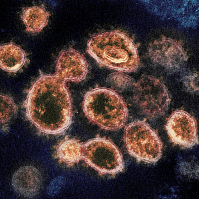 Il coronavirus SarsCoV2