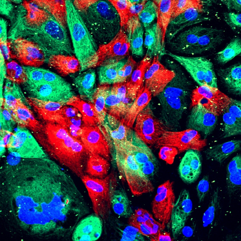 Cellule del tumore della prostata (fonte: National Institutes of Health)