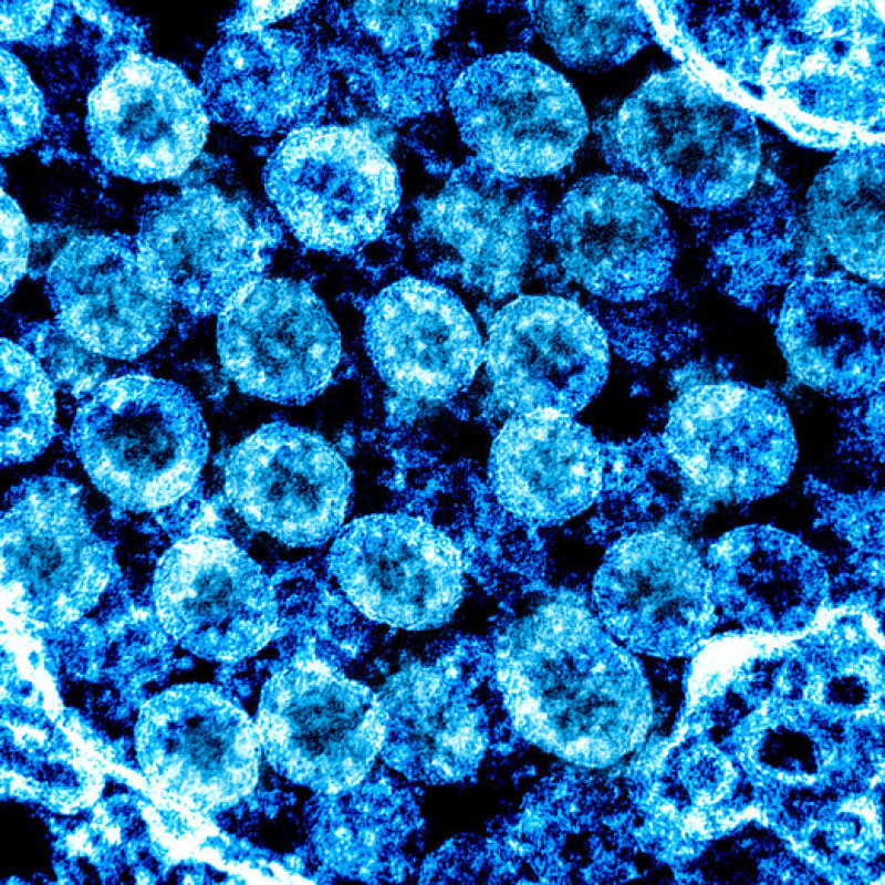 Particelle di coronavirus viste al microscopio eletttronico (fonte: NIAID)