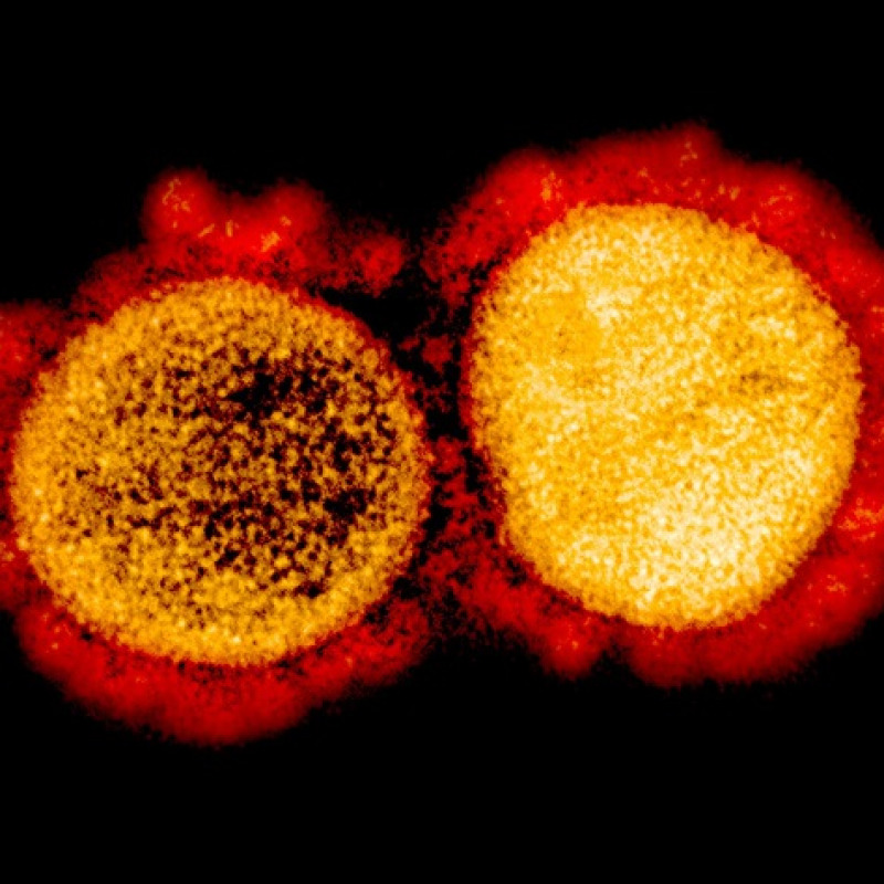 Particelle di coronavirus