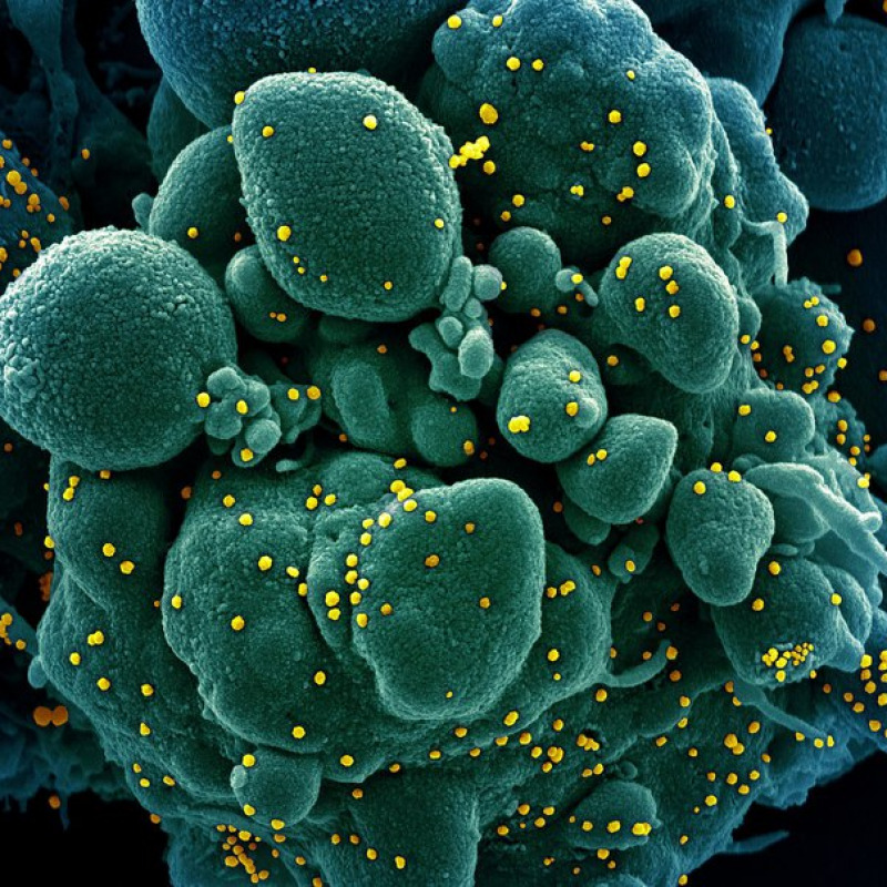 In giallo particelle del nuovo coronavirus su una cellula (fonte: NIAID)