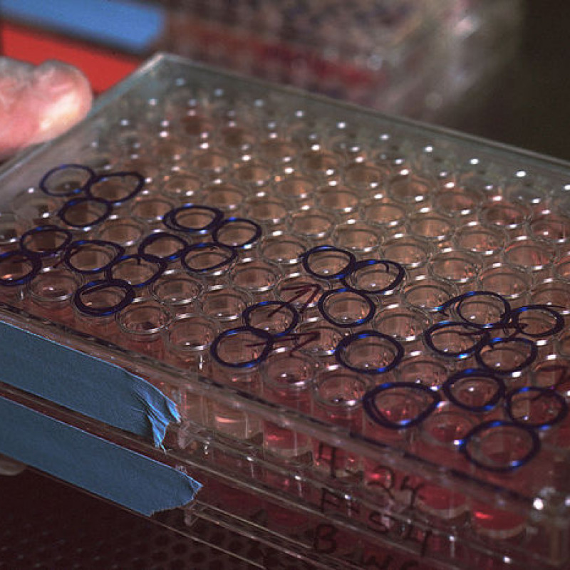 Preparazione di anticorpi monoclonali (foto di Linda Bartlett/ Wikipedia)