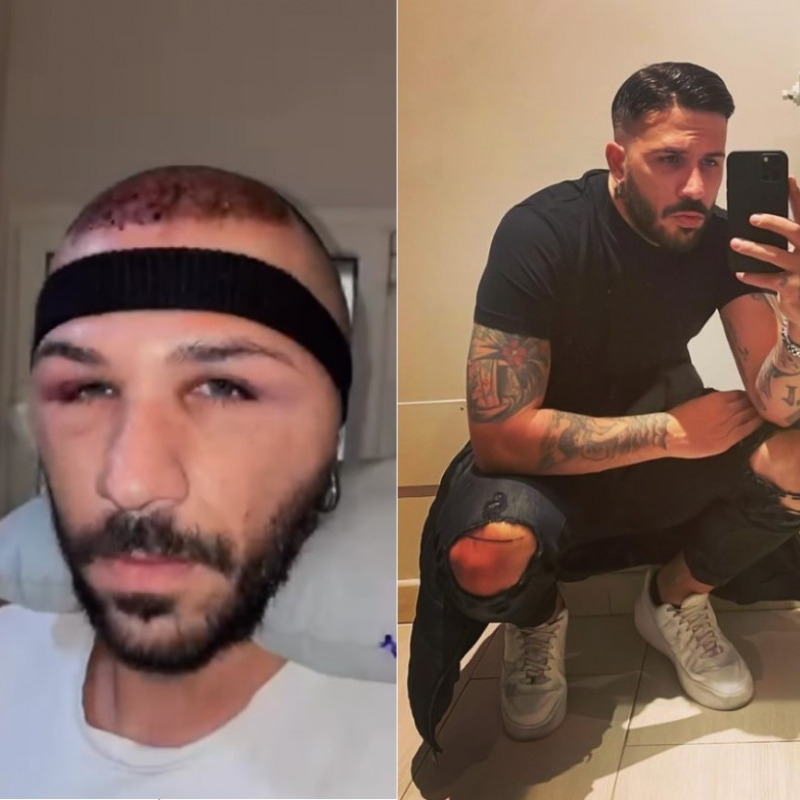 Federico Rasa in due foto pubblicate su Instagram (a sinistra nel post in cui spiega in quali condizioni si trovava all'Ospedale Civico)