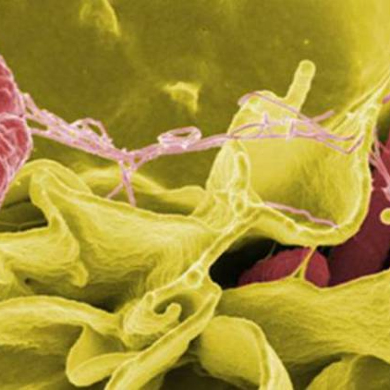 Il batterio della Salmonella invade cellule umane in coltura (fonte: Rocky Mountain Laboratories, NIAID, NIH)