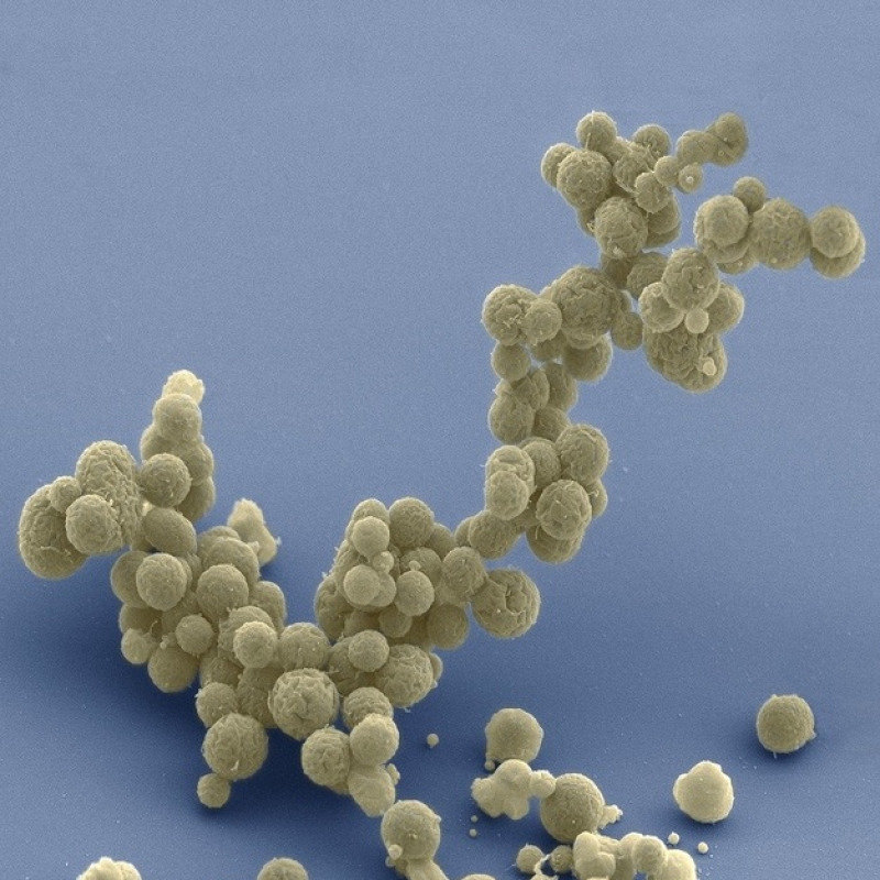 Un agglomerato di cellule sintetiche dal Dna minimale (fonte: T. Deerinck e M. Ellisman, National Center for Imaging and Microscopy Research, UCSD)