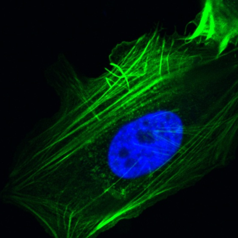 In azzurro il nucleo di una cellula ricco della proteina Grp78 (fonte: Ze Liu, PhD, Amy Lee, PhD)