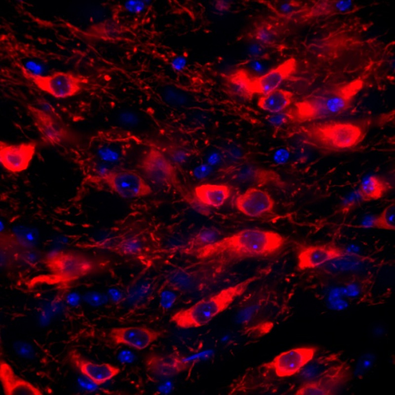 Dopaminergic neuronsi (credit: Marcello Serra)