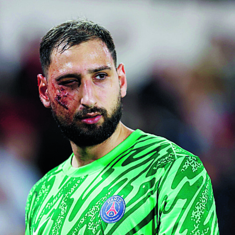 epaselect epa11784513 Goalkeeper Gianluigi Donnarumma of Paris Saint Germain leaves the pitch after receiving an injury during the French Ligue 1 soccer match AS Monaco vs Paris Saint Germain, at Stade Louis II, in Monaco, 18 December 2024. EPA/SEBASTIEN NOGIER