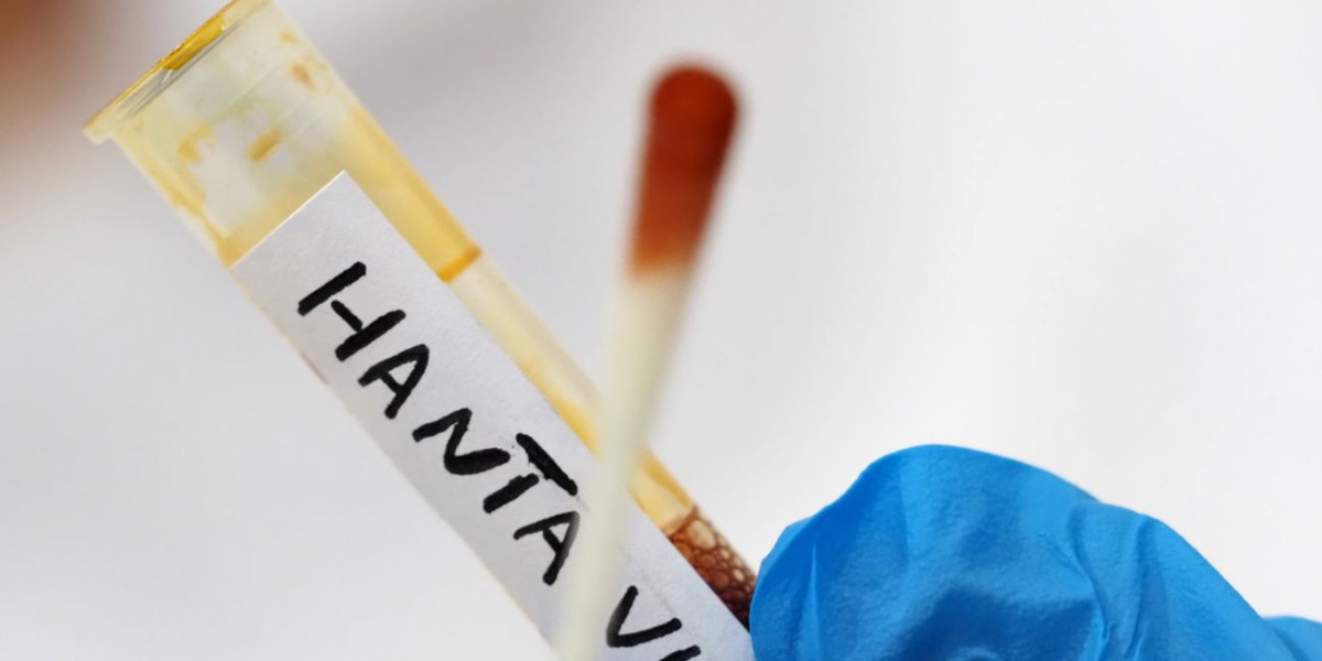 https://assets.gds.it/2026/05/hantavirus-il-ministero-della-salute-conferma-8220non-risultano-casi-registrati-in-italia8221-2144389-1200x600.jpg